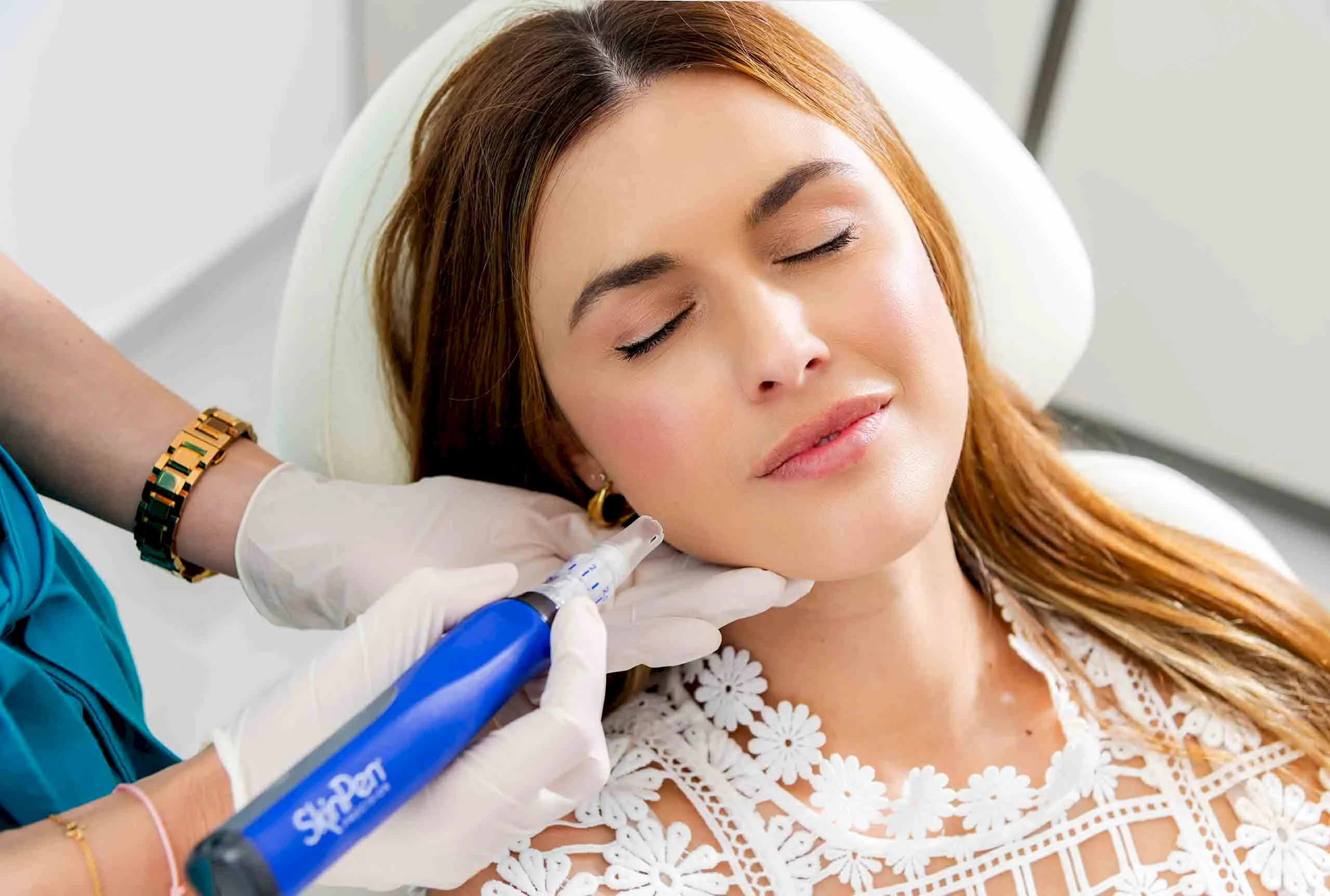 Microneedling 